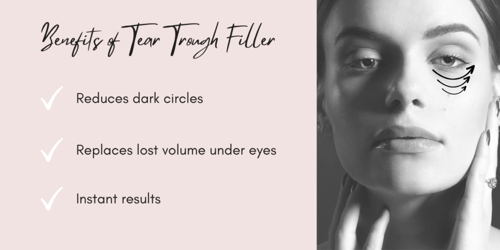 Benefits of Tear Trough filler Blossom Cosmetic Clinic