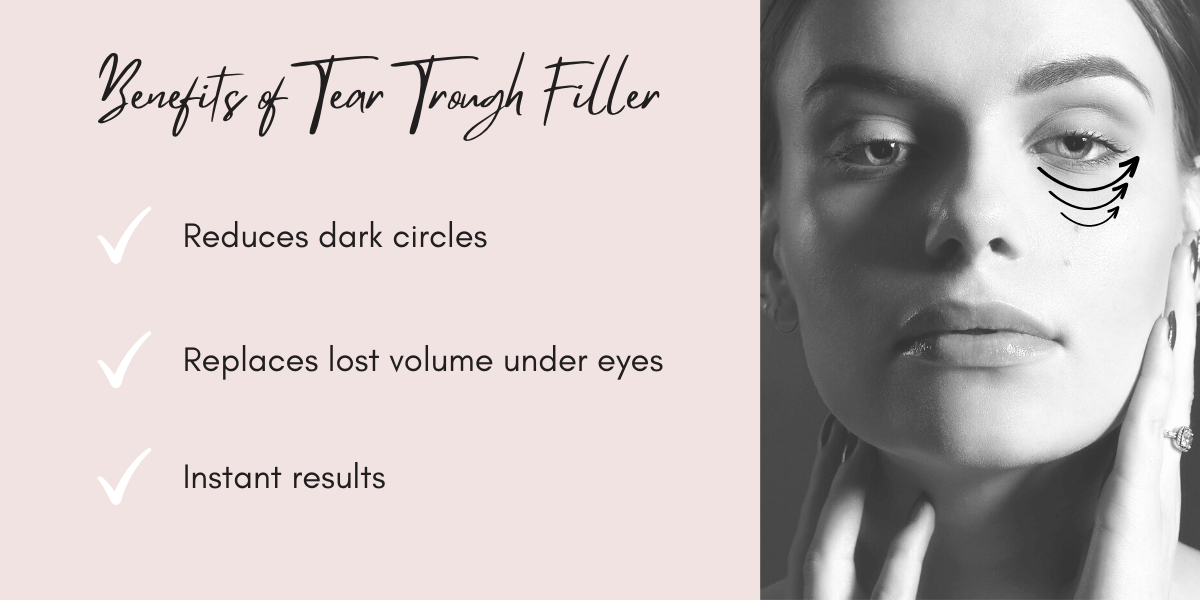 Tear trough filler infographic with all the benefits in York. Reduce dark circles, replaces lost volume under eyes and instant results 