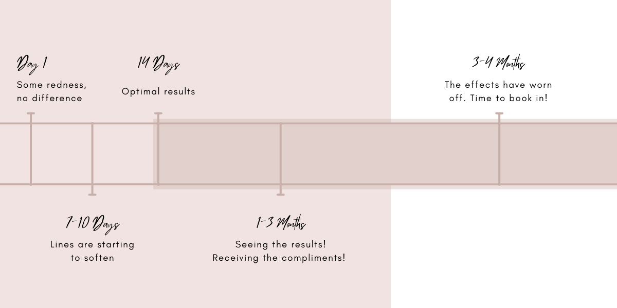 Botox timeline inforgraphic at Blossom Cosmetic Clinic in York.
Day 1, some redness no difference, 7 to 10 days lines are starting to soften, 14 days optimal results, 1 to 3 months seeing the results and receiving compliments, 3 to 4 months the effects have worn off, time to book in! 