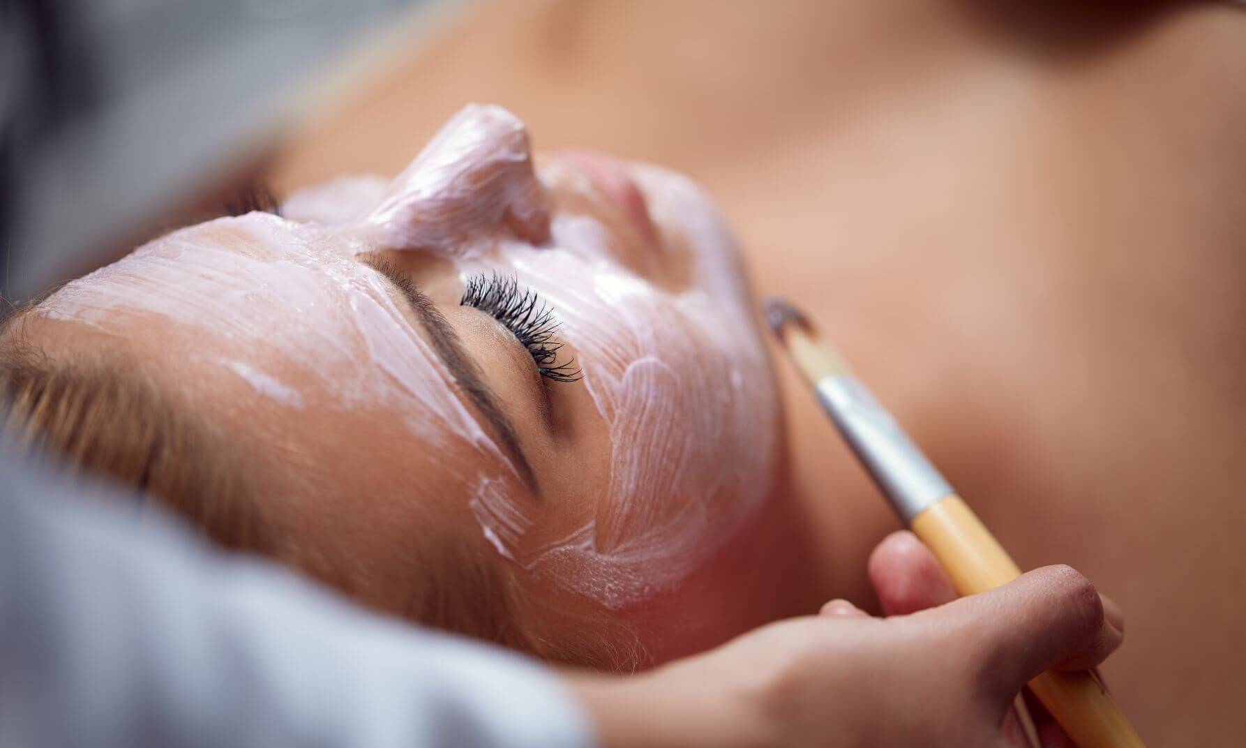 What Are The Benefits Of Cosmetic Peels?