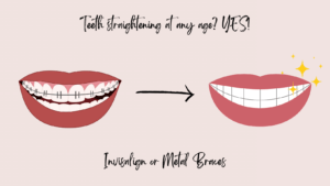 Braces to straight teeth graphic. Teeth straightening at any age? Yes! 