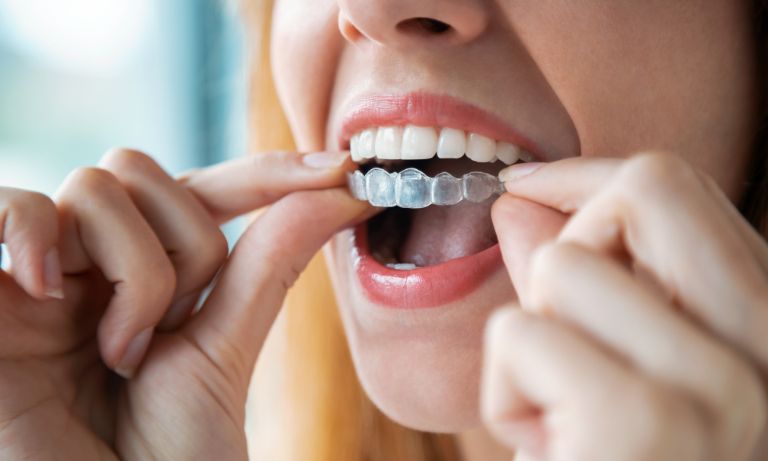 Woman putting Invisalign braces in at York cosmetic clinic